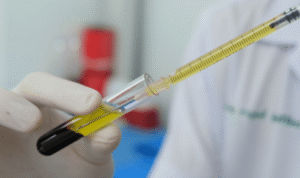 The P-Shot in London: All You Need to Know About This Innovative Treatment